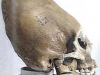conehead-skull